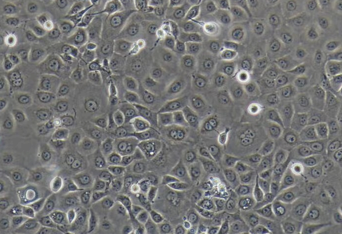 人非小細胞肺癌細胞NCI-H1650(STR鑒定正確)