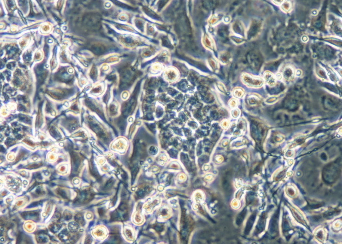人膽囊癌細胞NOZ(STR鑒定正確)