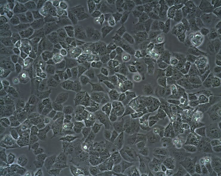 人十二指腸腺癌HuTu 80(STR鑒定正確)