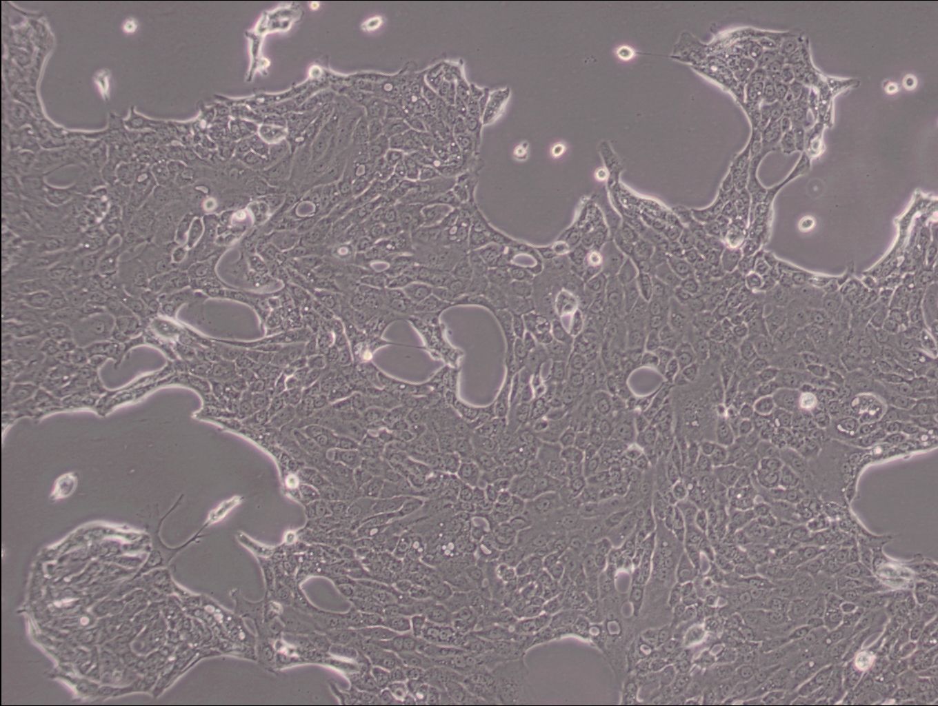 人胰腺導管癌細胞CFPAC-1(STR鑒定正確)