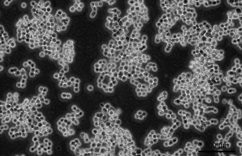 人結直腸腺癌細胞COLO320 (STR鑒定正確)