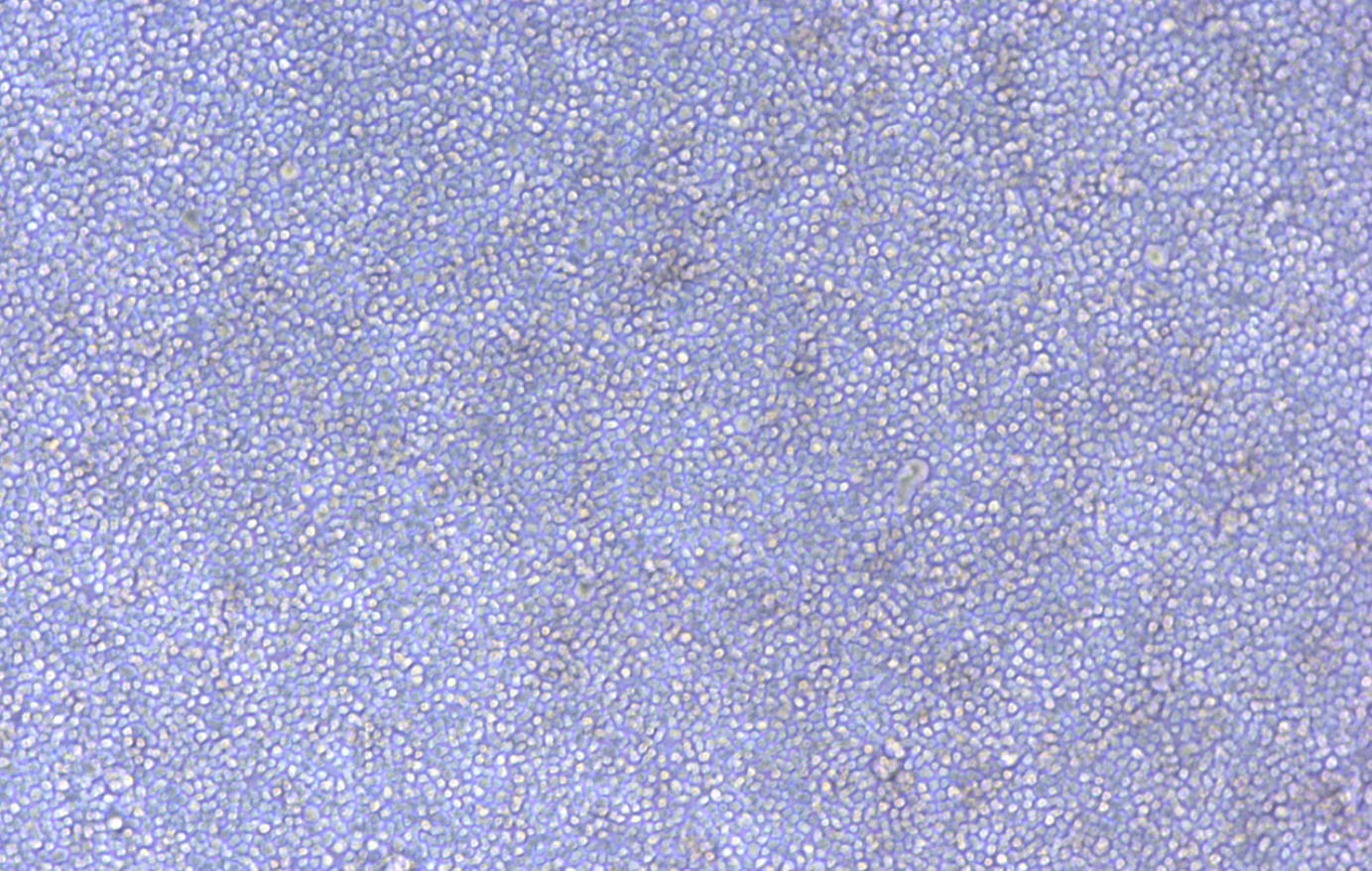 人彌漫大B細(xì)胞淋巴瘤細(xì)胞Toledo(STR鑒定正確)