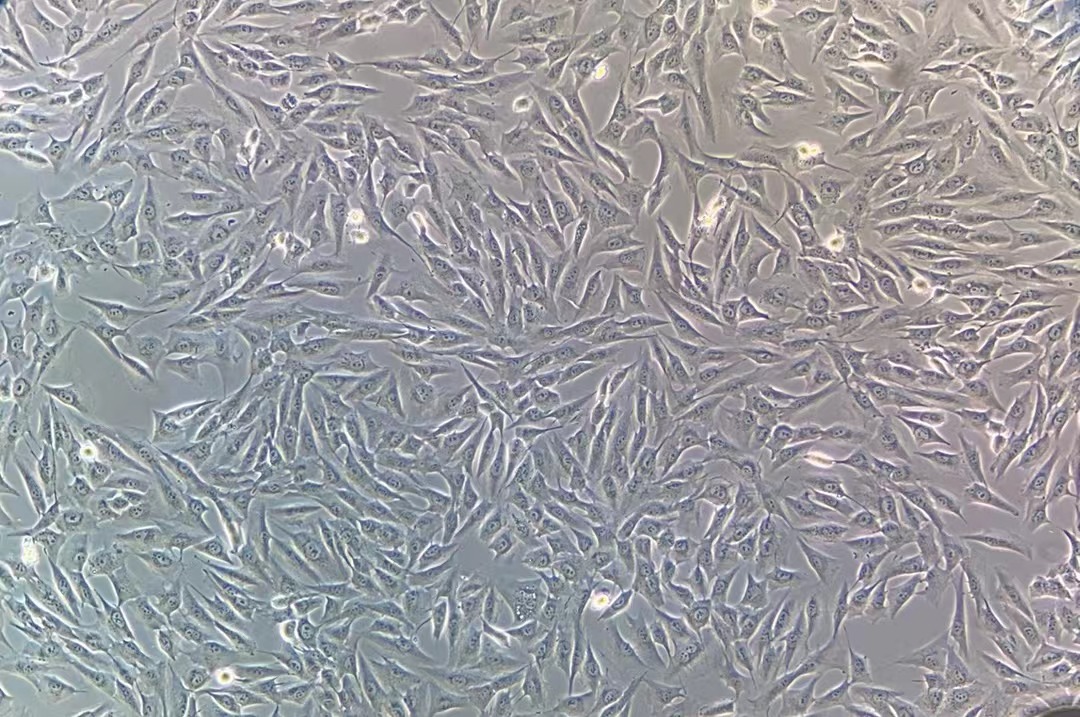 人成骨肉瘤細(xì)胞MG-63(STR鑒定正確)