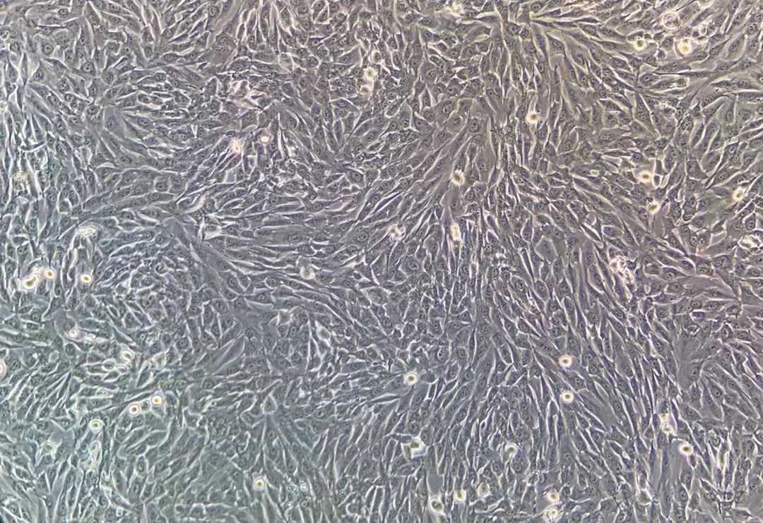 人成骨肉瘤細(xì)胞MG-63(STR鑒定正確)