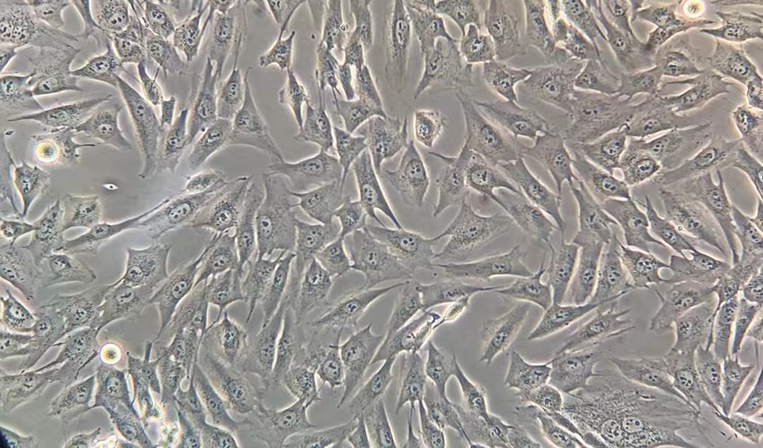 人成骨肉瘤細(xì)胞MG-63(STR鑒定正確)