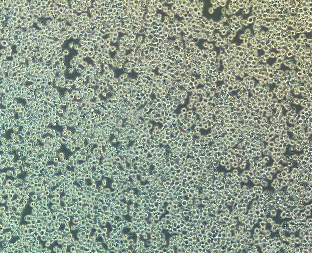 小鼠淋巴瘤細(xì)胞EL4(種屬鑒定)