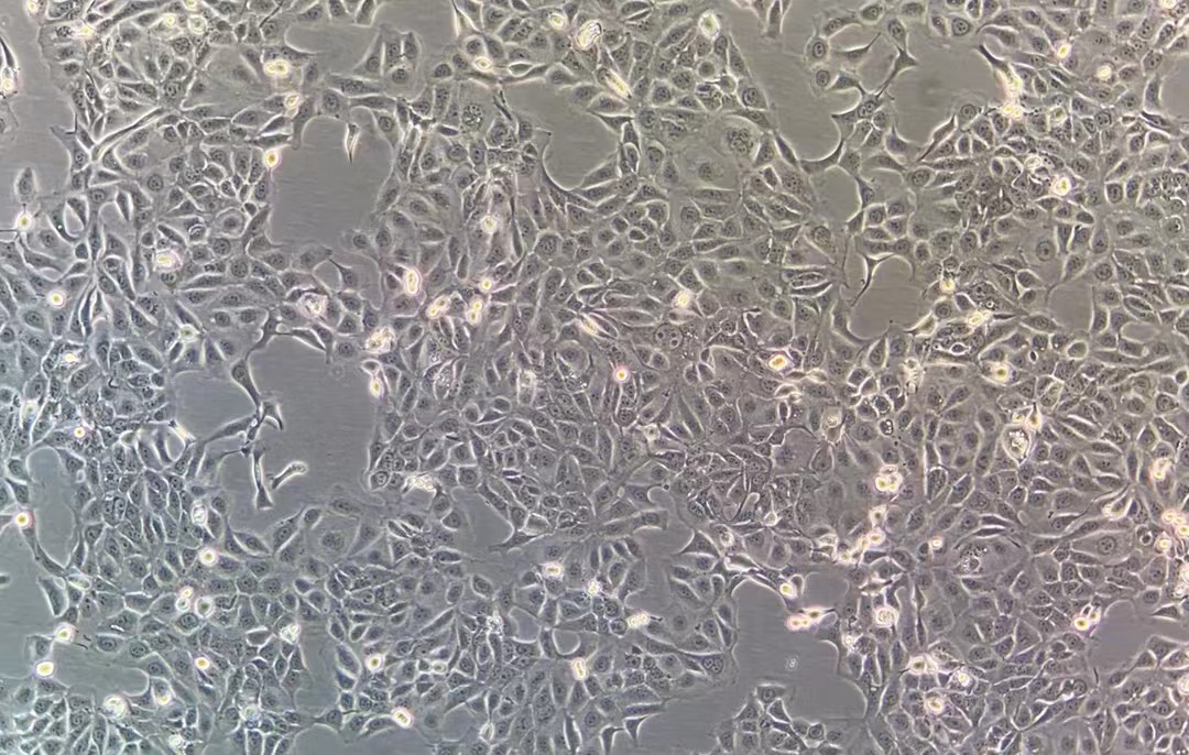人角膜上皮細胞系 HCE-T(STR鑒定正確)
