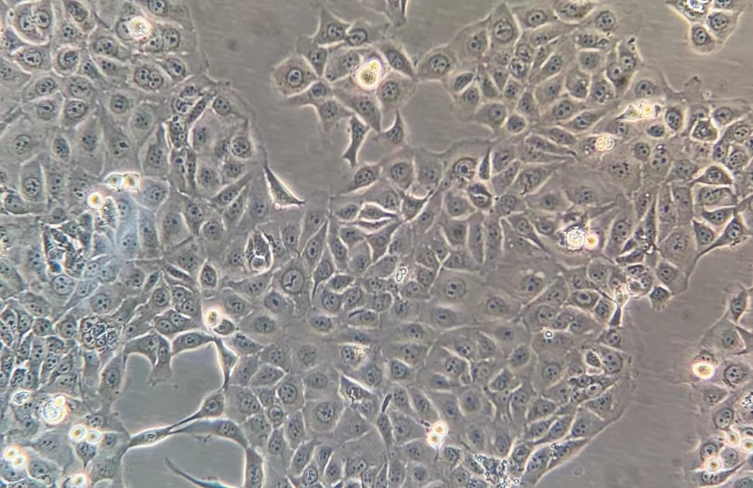 人角膜上皮細胞系 HCE-T(STR鑒定正確)