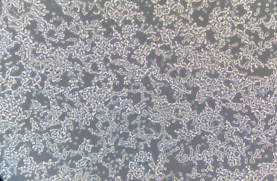 人視網(wǎng)膜母細(xì)胞瘤WERI-Rb-1(STR鑒定正確)