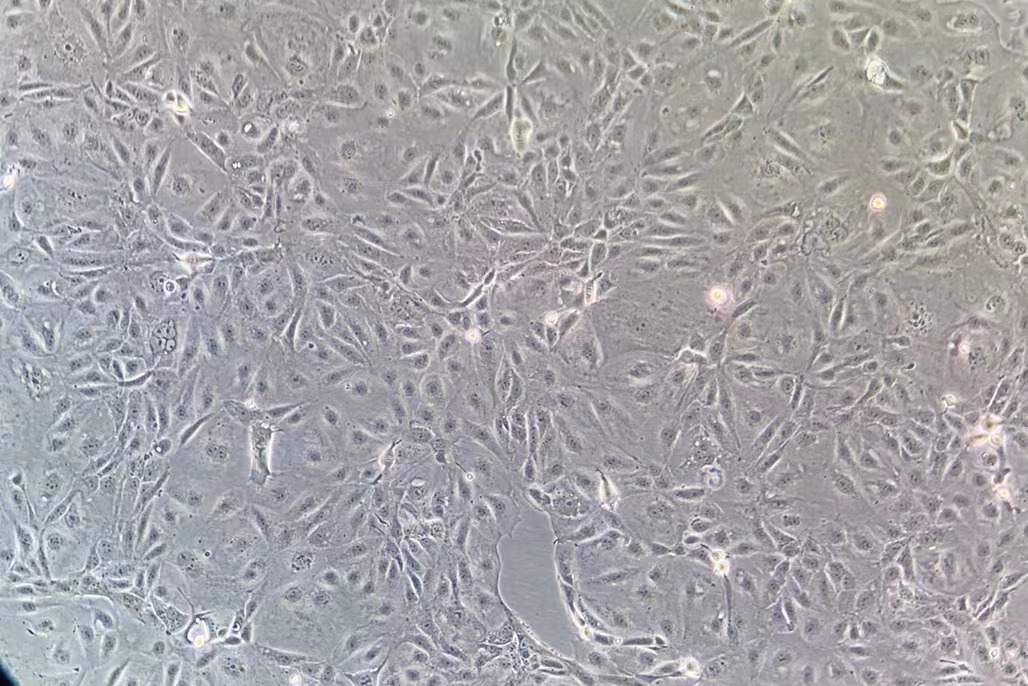 人胃癌細(xì)胞MKN-7(STR鑒定正確)