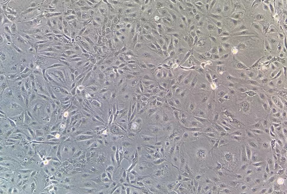 人胃癌細(xì)胞MKN-7(STR鑒定正確)