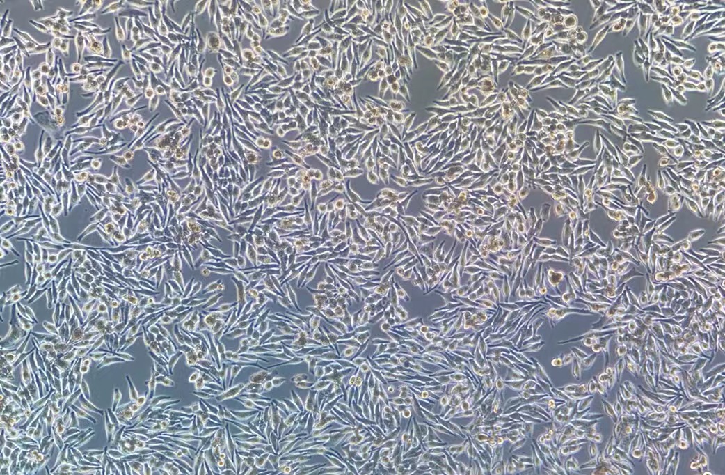 人黑色素瘤細胞MNT-1?(STR鑒定正確)