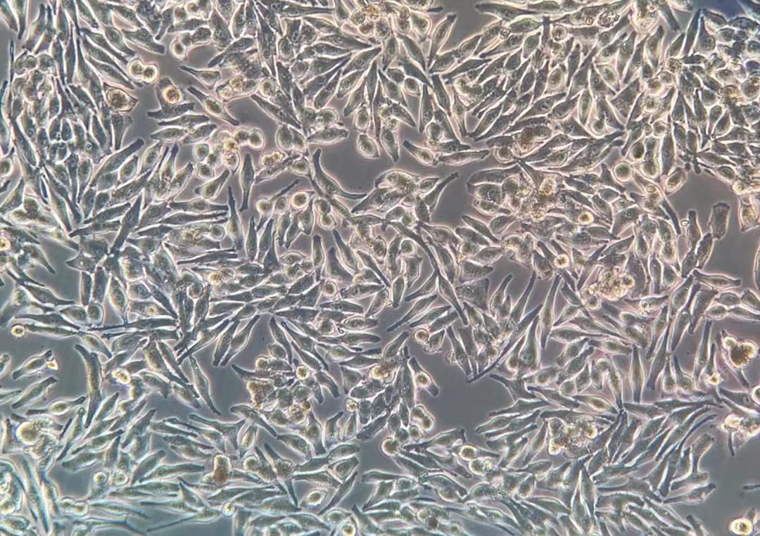 人黑色素瘤細胞MNT-1?(STR鑒定正確)