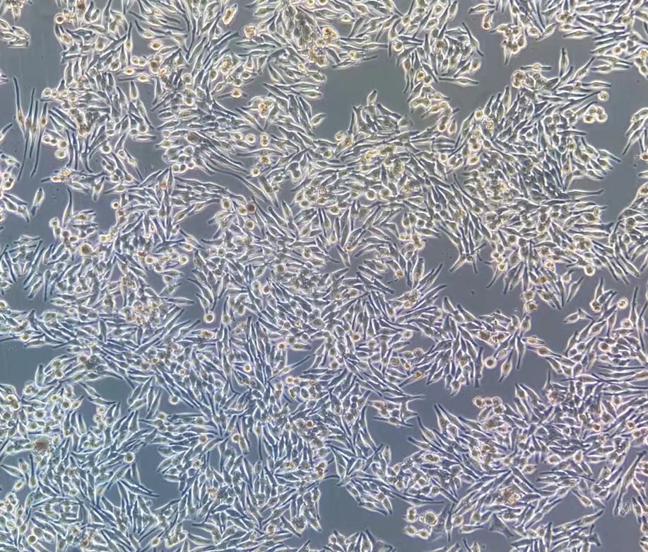 人黑色素瘤細胞MNT-1?(STR鑒定正確)