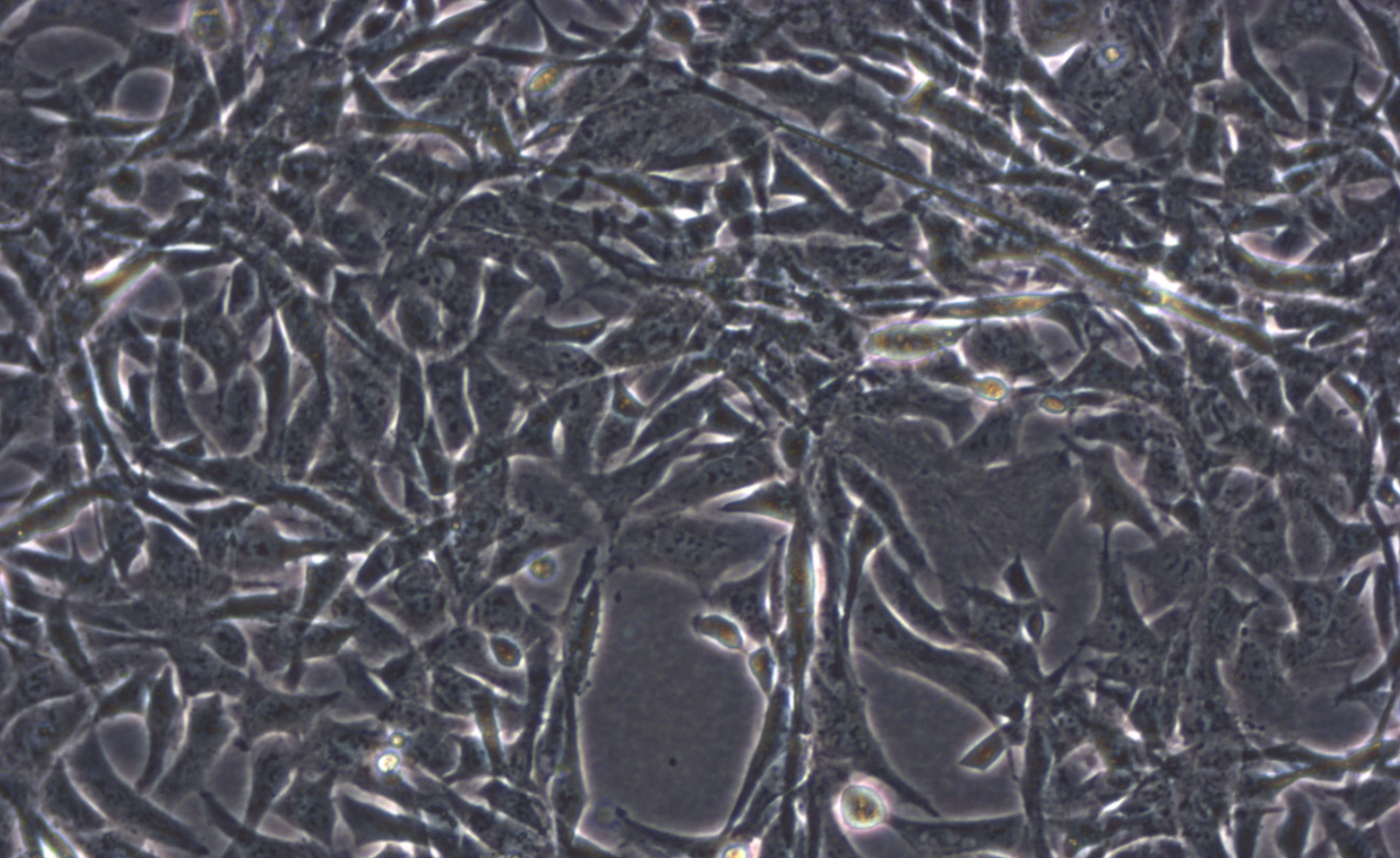 人惡性胚胎橫紋肌瘤細胞RD(STR鑒定正確)