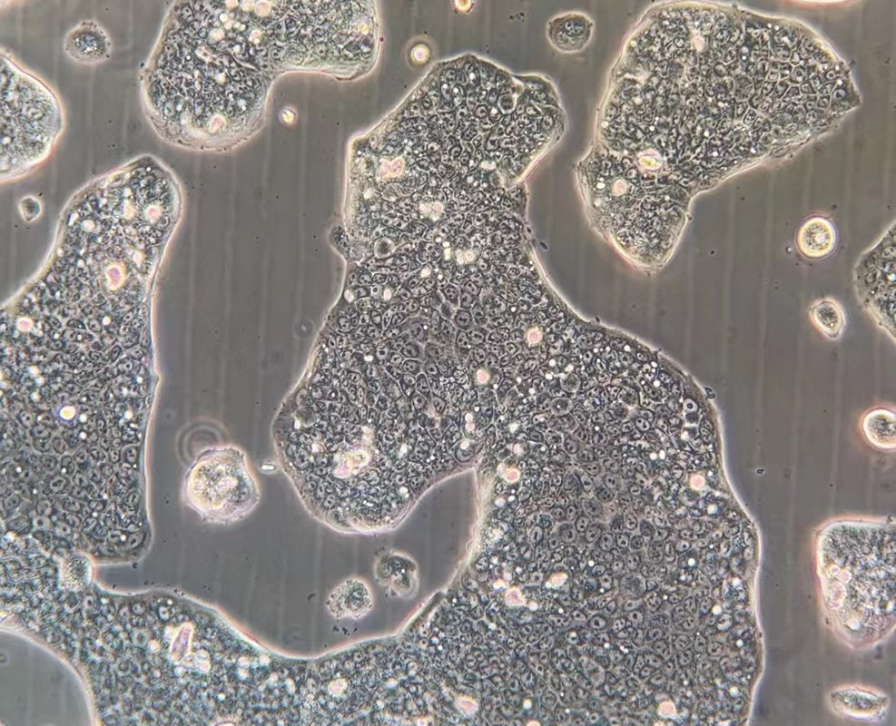 人胃癌細胞NCI-N87(STR鑒定正確)