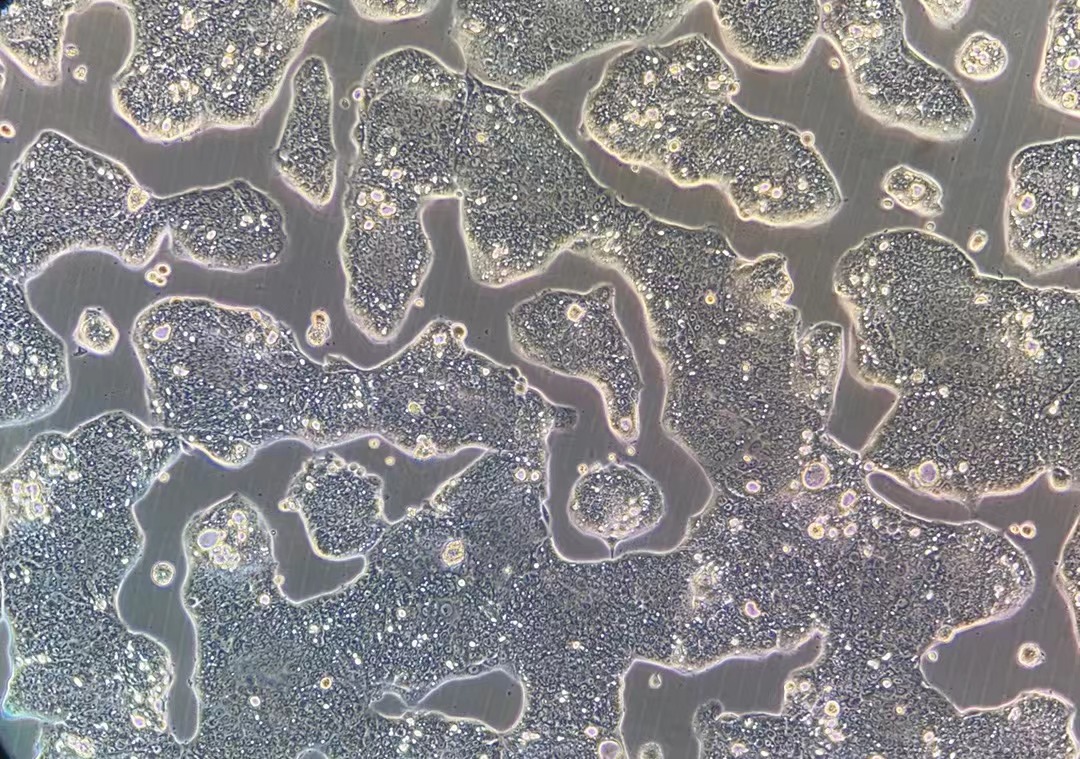 人胃癌細胞NCI-N87(STR鑒定正確)