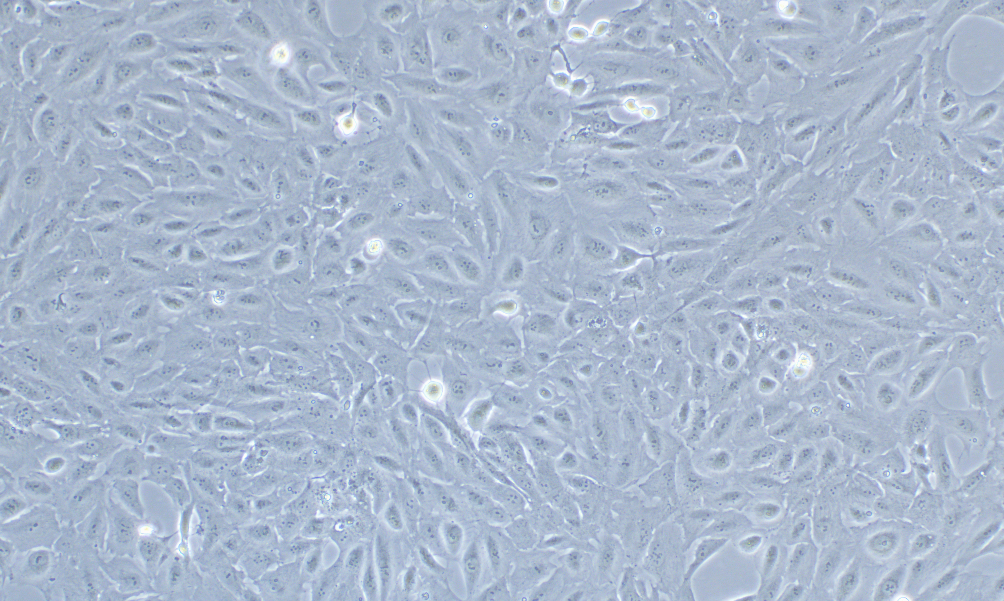 人Ⅱ型肺泡上皮細胞永生化