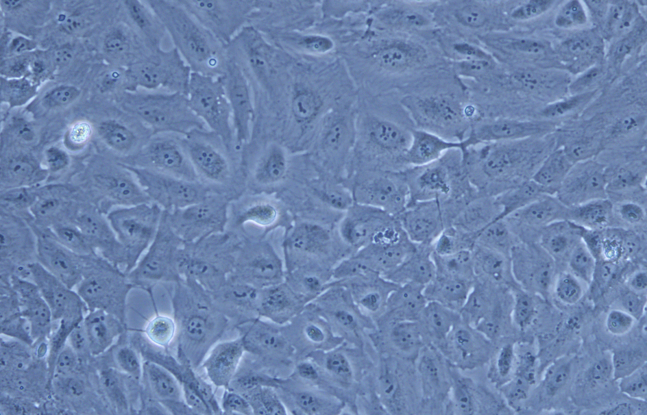 人Ⅱ型肺泡上皮細胞永生化