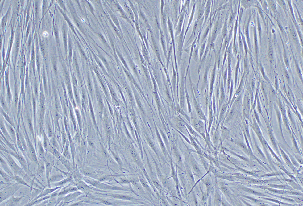 人淋巴結成纖維細胞