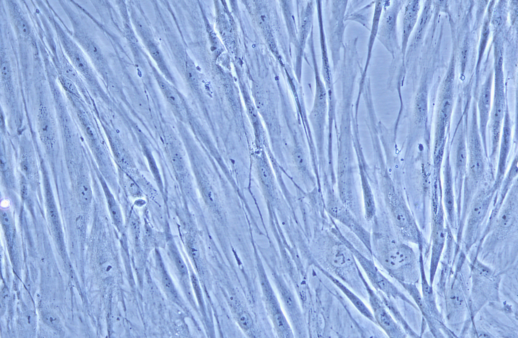 人淋巴結成纖維細胞