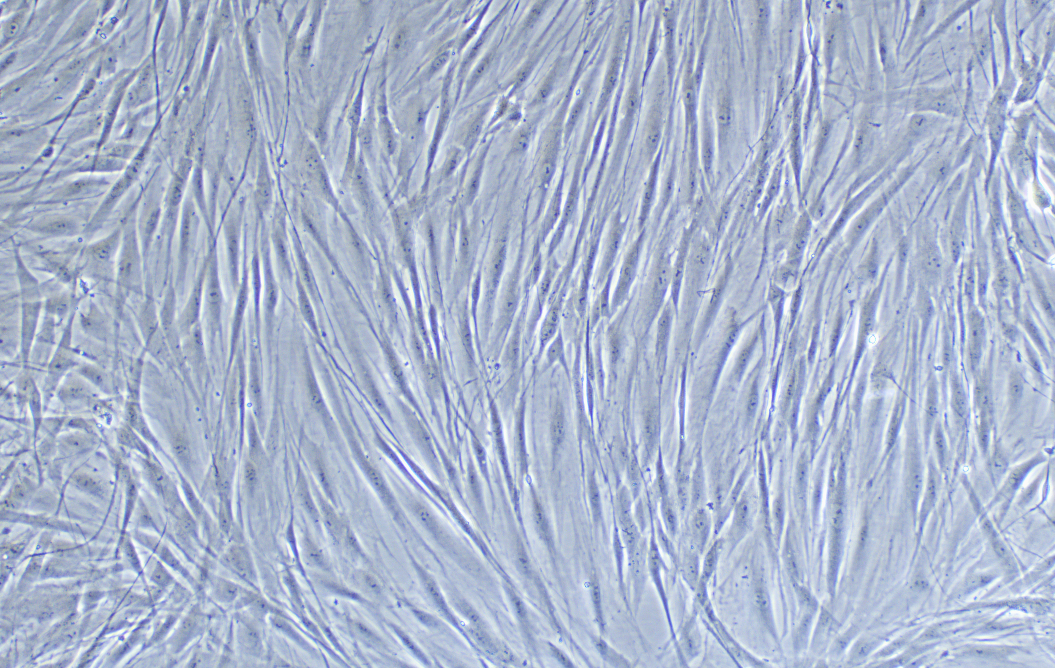 人淋巴結成纖維細胞
