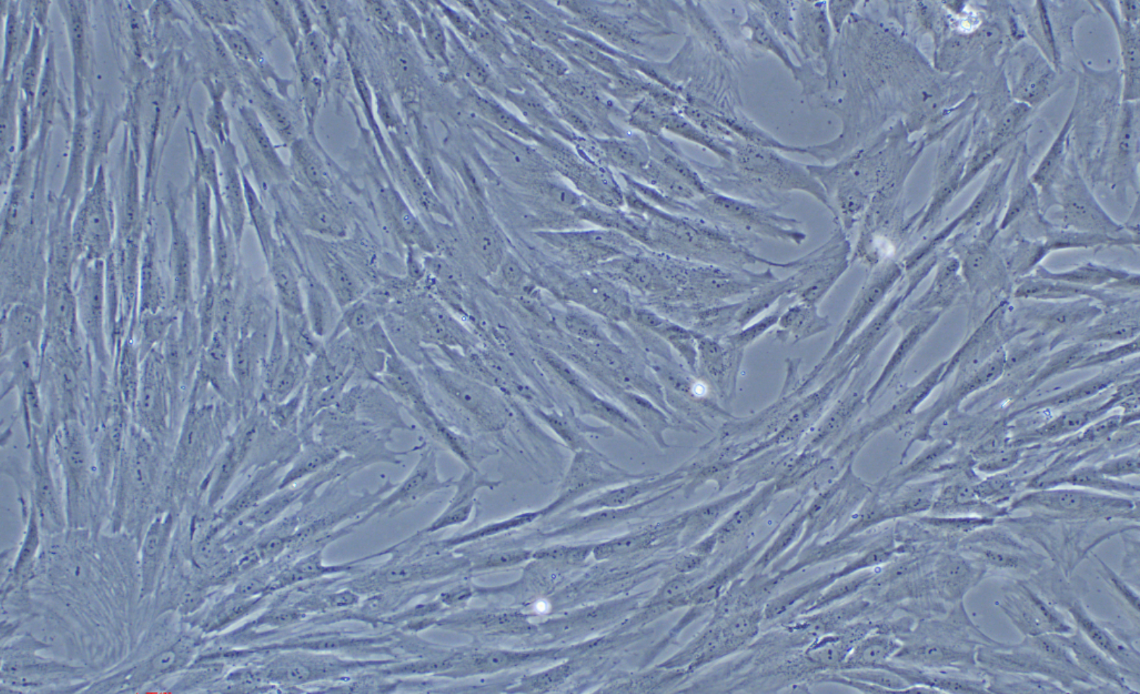人羊膜間充質干細胞