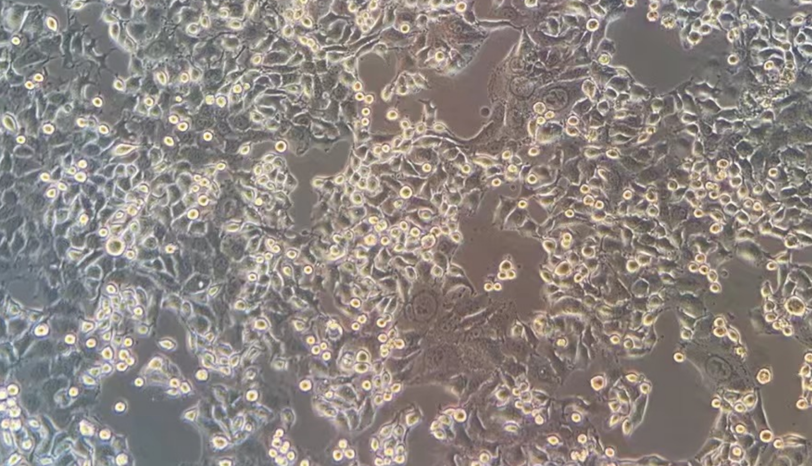 人肺鱗癌細胞HCC95(STR鑒定正確)