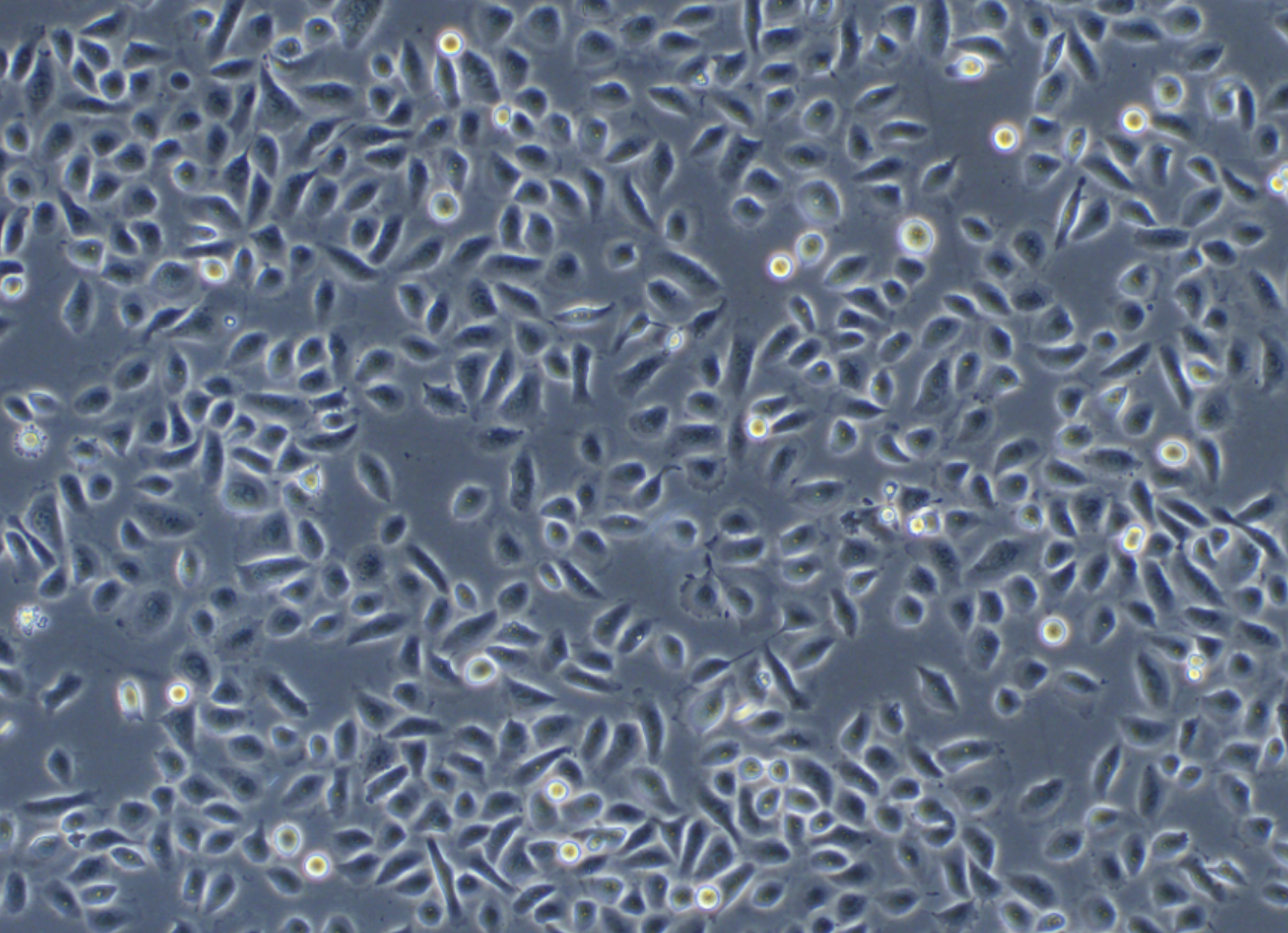 人支氣管上皮樣細胞 HBE HBE135-E6E7(STR鑒定正確)