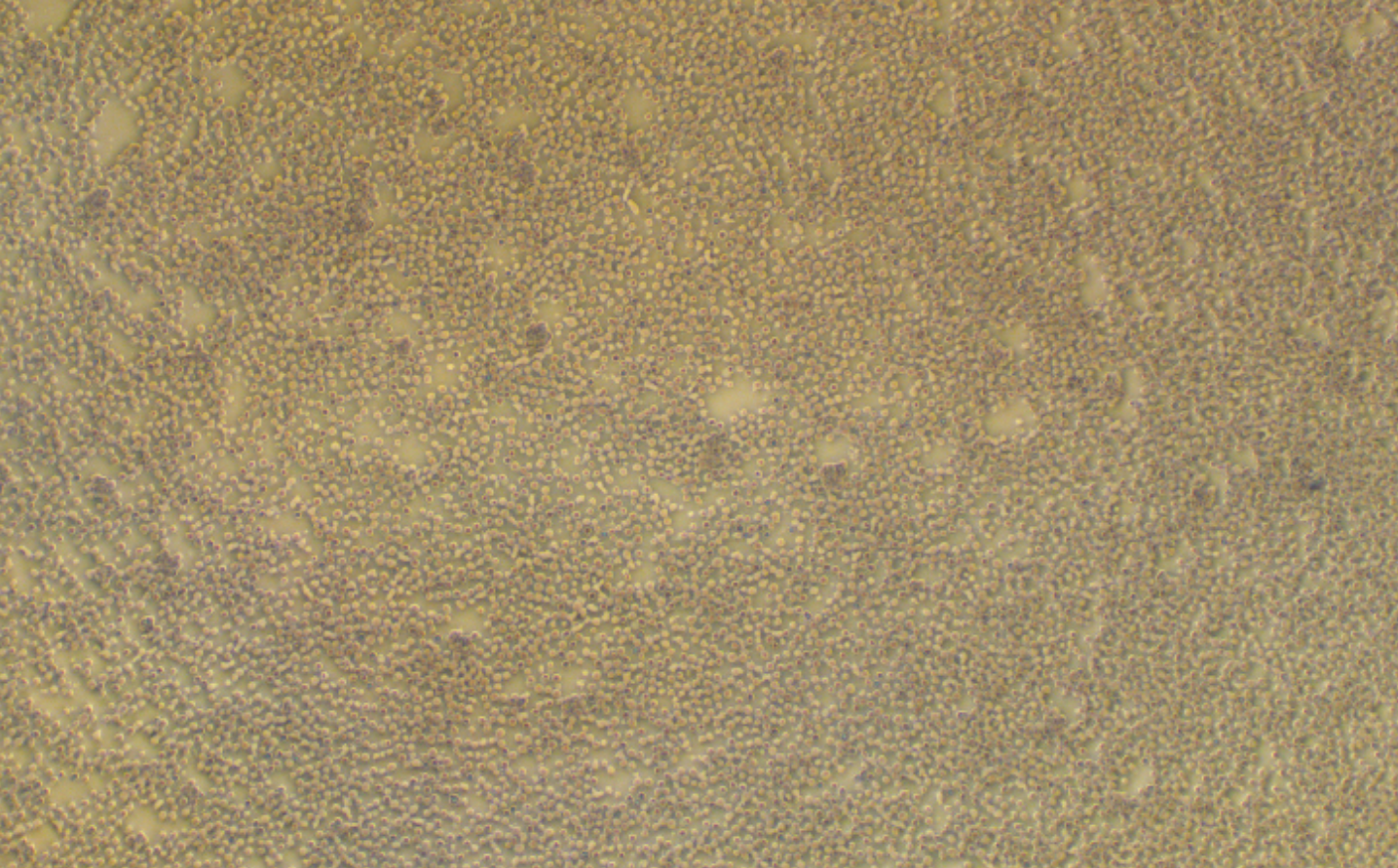 人急性淋巴母細胞性白血病細胞MOLT-4(STR鑒定正確)