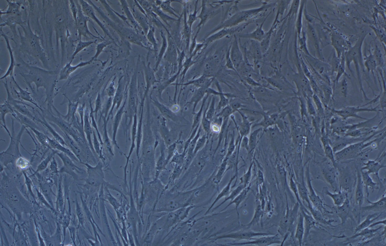人結直腸癌相關成纖維細胞