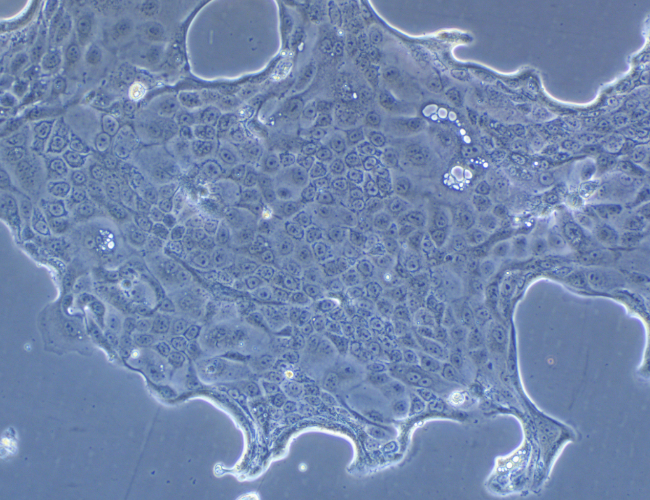 人肺腺癌細胞Calu-3(STR鑒定正確)