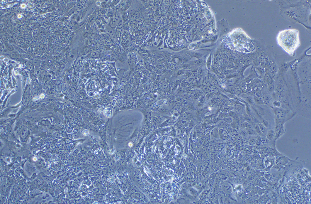 人大腸癌細胞SW1463