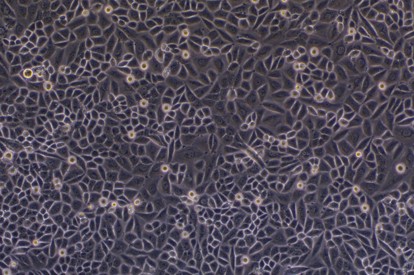人子宮頸鱗狀細胞癌細胞SiHa(STR鑒定正確)