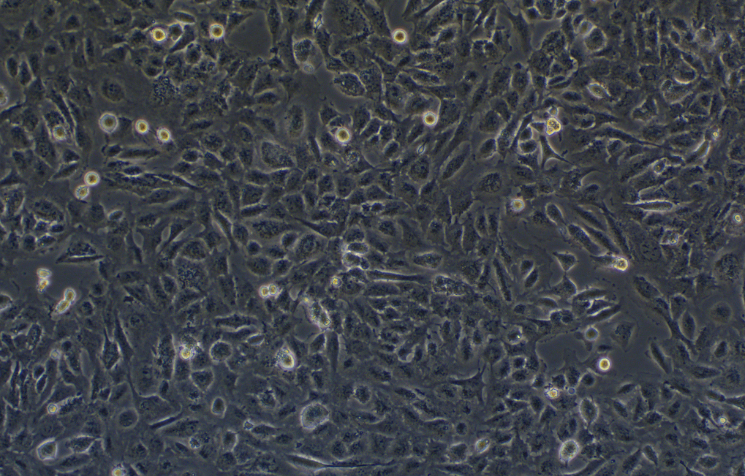 人小膠質細胞HMC3(STR鑒定正確)
