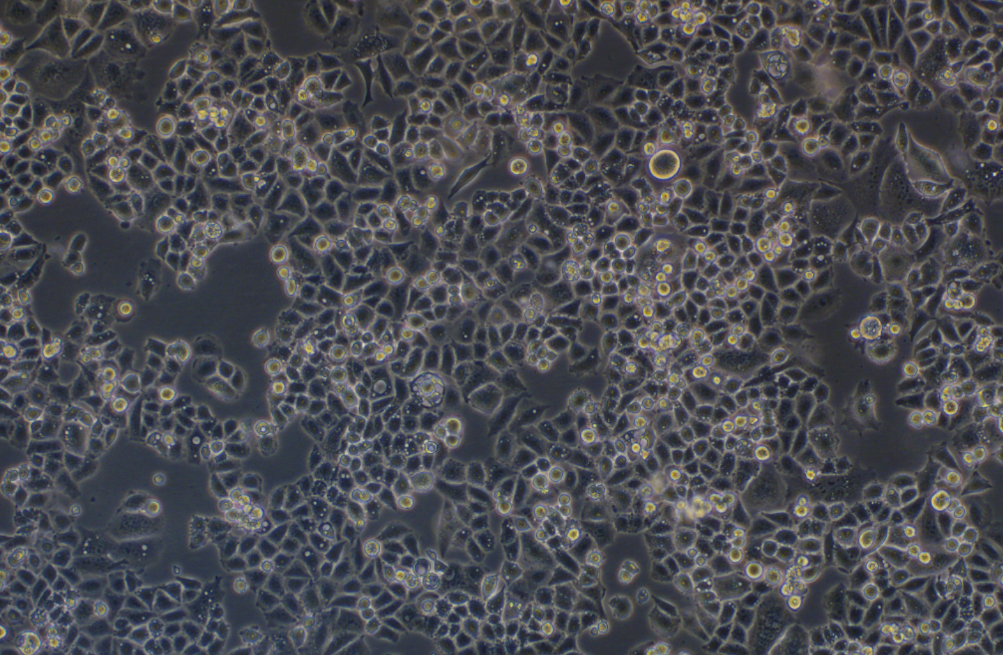 人宮頸癌細胞C33A(STR鑒定正確)
