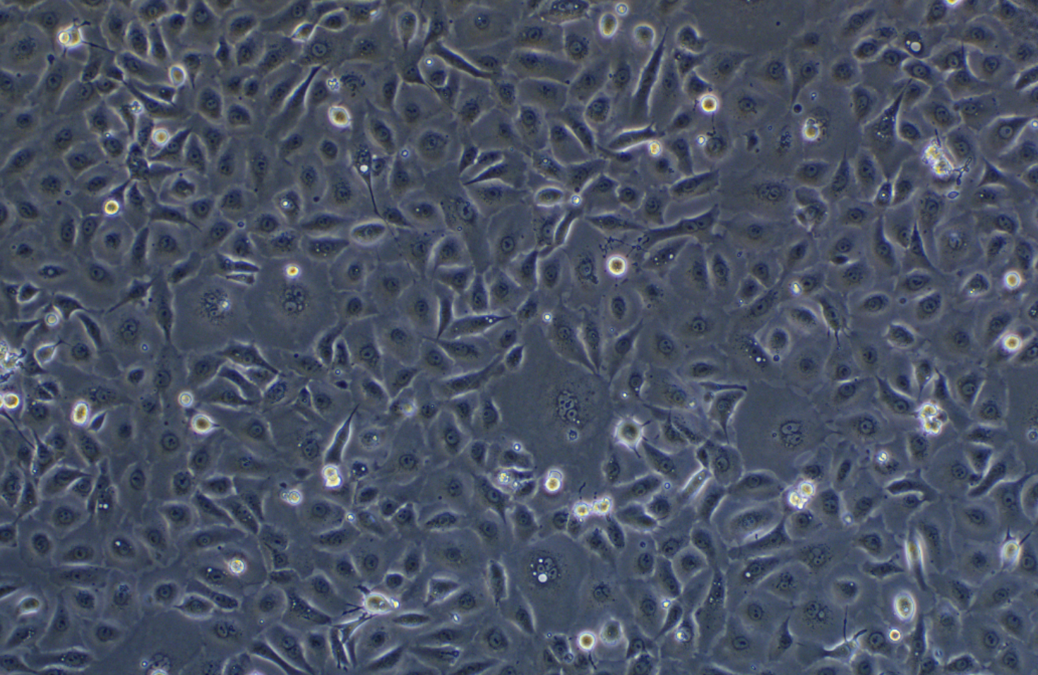 人非小細胞肺癌細胞NCI-H1650(STR鑒定正確)
