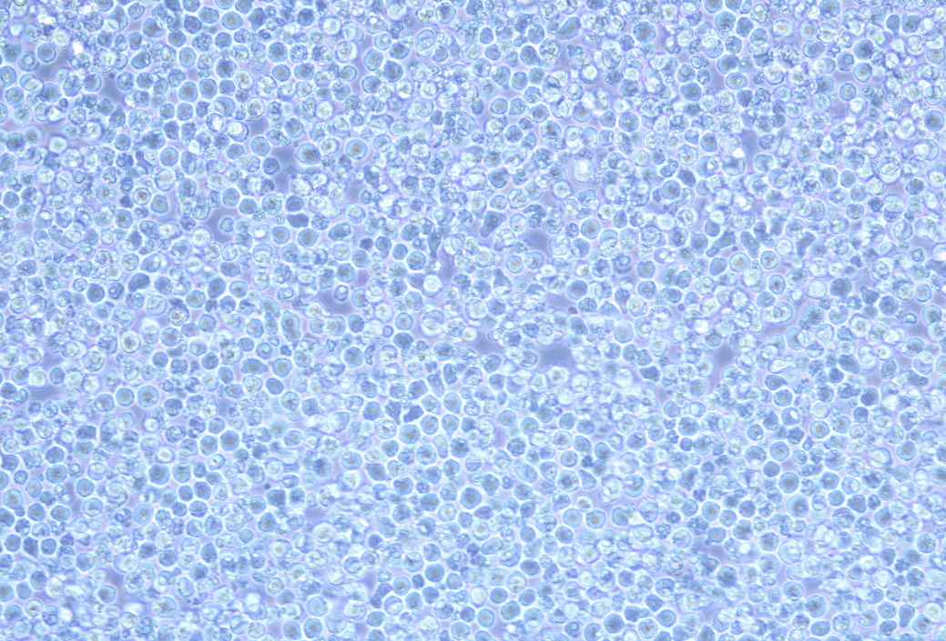 人白血病細胞BV-173(STR鑒定正確)