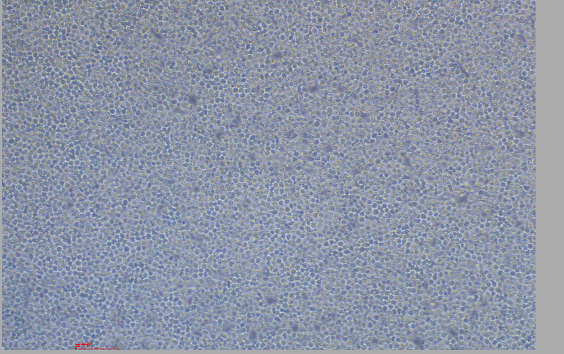 人白血病細胞BV-173(STR鑒定正確)