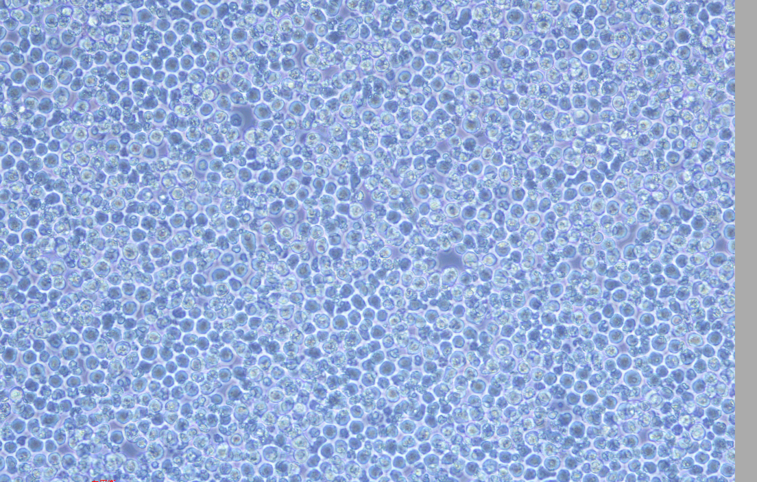 人白血病細胞BV-173(STR鑒定正確)