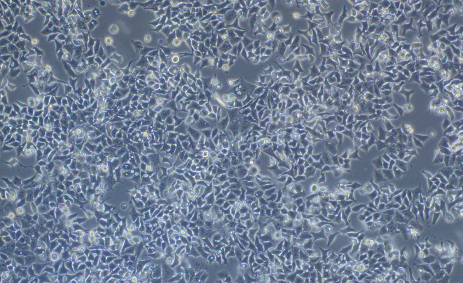 食管鱗狀細胞癌 KYSE-180(STR鑒定正確)