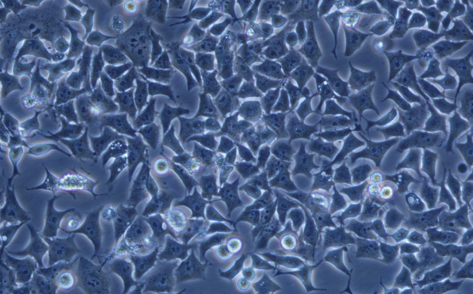 食管鱗狀細胞癌 KYSE-180(STR鑒定正確)