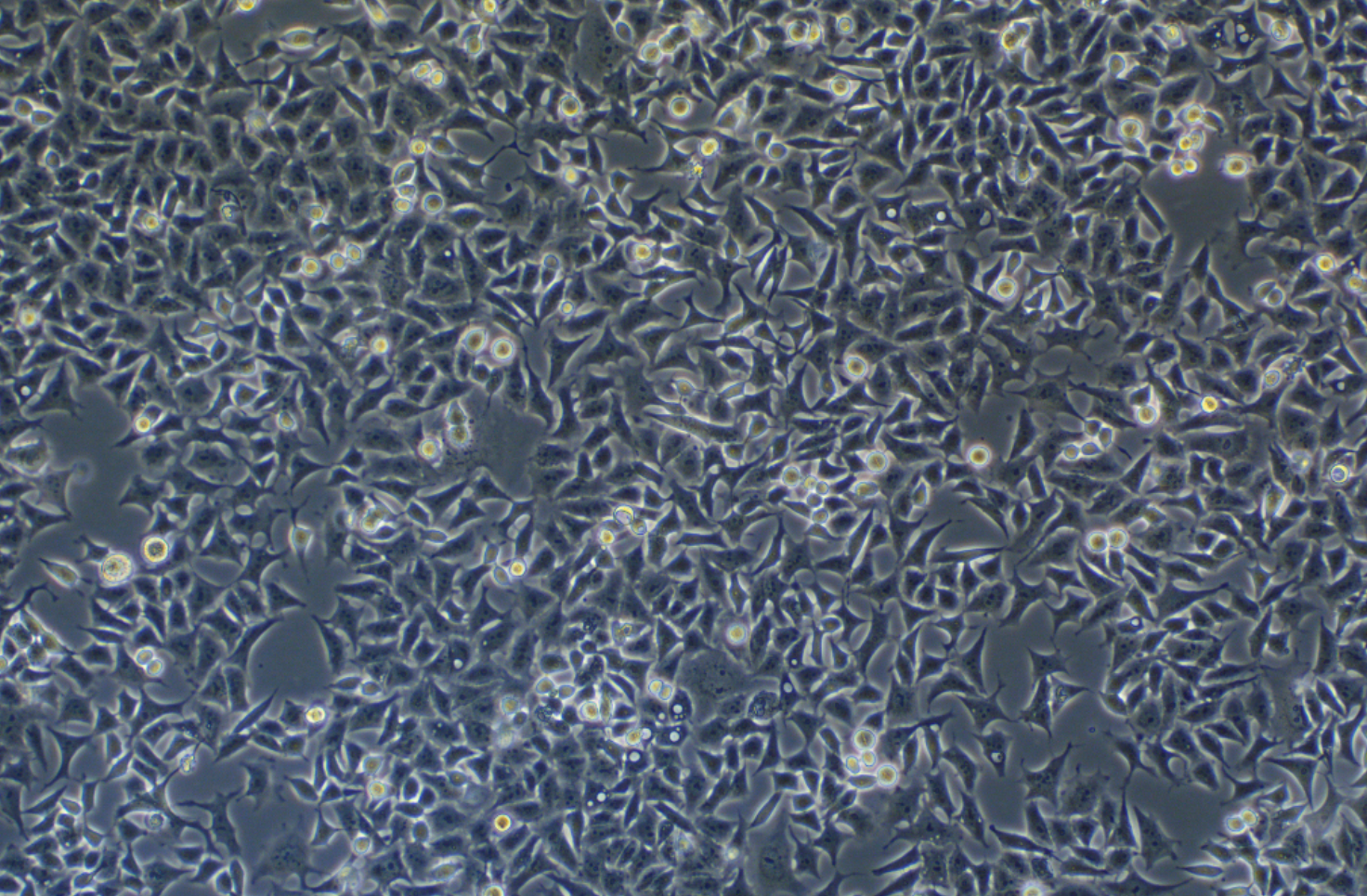 食管鱗狀細胞癌 KYSE-180(STR鑒定正確)