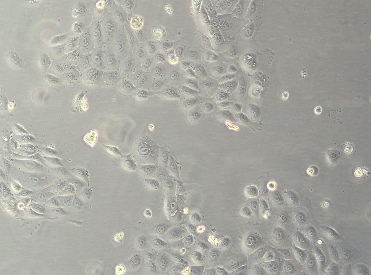 人前列腺增生細(xì)胞BPH-1 ?(STR鑒定正確)