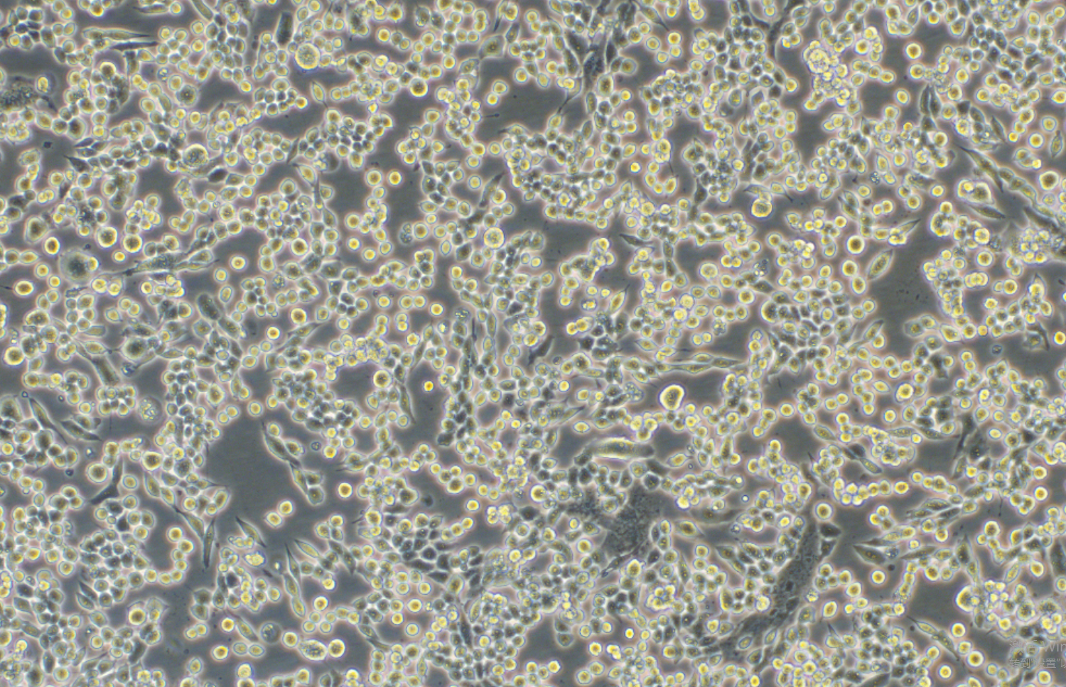 小鼠肺癌細胞LLC(STR鑒定正確)