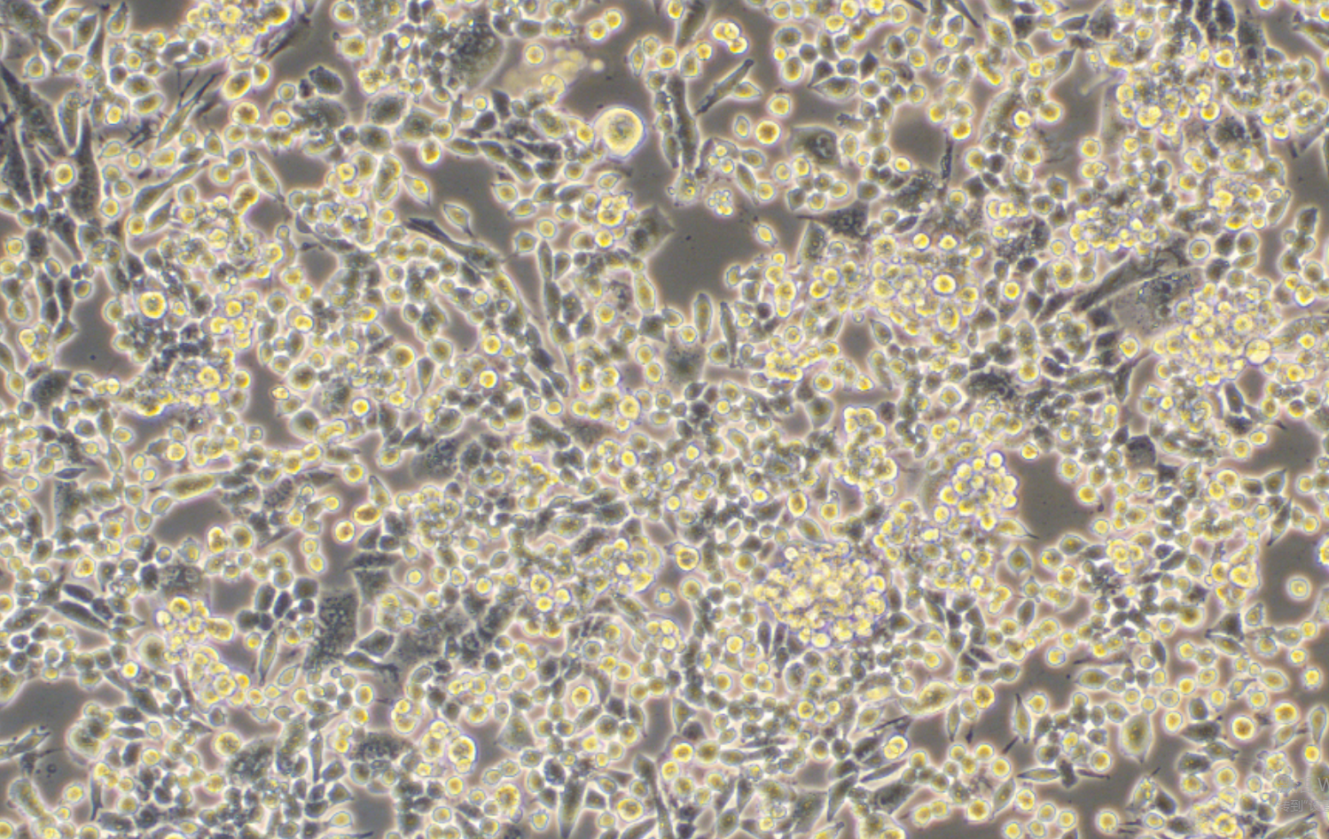 小鼠肺癌細胞LLC(STR鑒定正確)