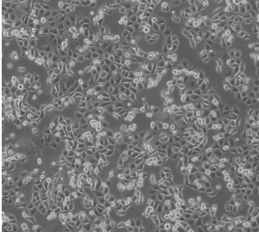 人食管鱗癌細胞KYSE-30(STR鑒定正確)