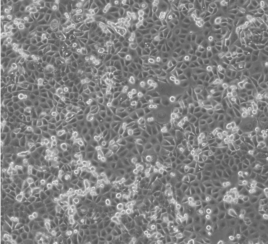 人食管鱗癌細胞KYSE-30(STR鑒定正確)