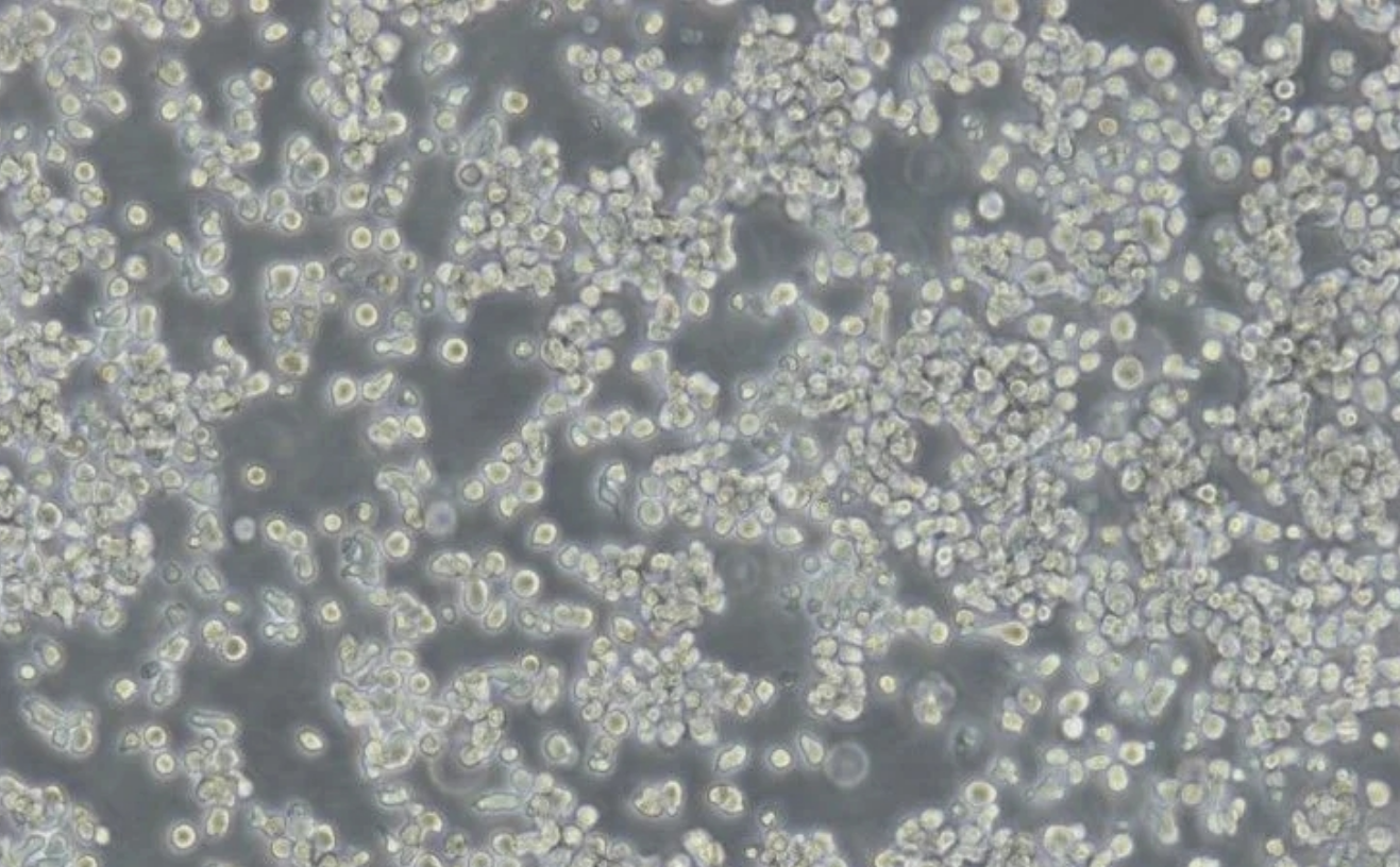 人T淋巴細(xì)胞白血病細(xì)胞HuT 78(STR鑒定正確)