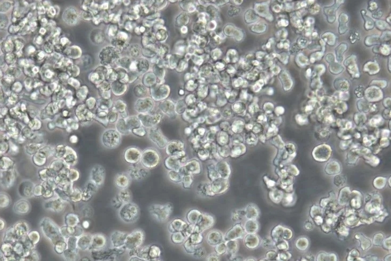 人T淋巴細(xì)胞白血病細(xì)胞HuT 78(STR鑒定正確)